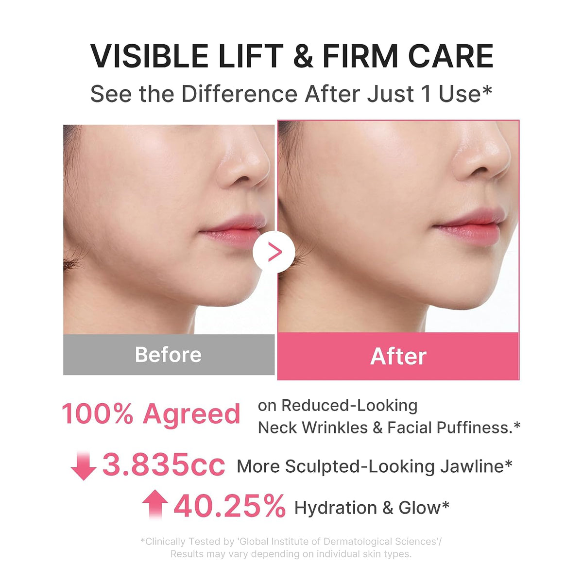 [NEW] [medicube] PDRN Collagen Gua Sha Neck Wrinkle Cream | Built-In Gua Sha Massager with Volufiline 5% + PDRN | Firming, Contour Care for the Look of Fine Lines, Jawline, Neck, Décolleté | Massage Cream | Korean Skincare